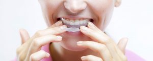 Read more about the article Dental Hygiene Preferred Night Guard