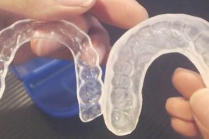 TeethNightGuard Reviews (Sparkling White Smiles Night Guard)