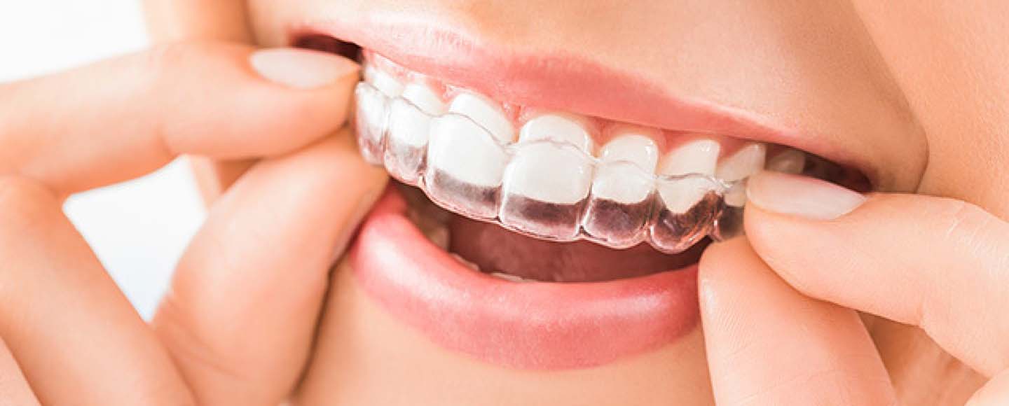 Can a Night Guard Shift Your Teeth?