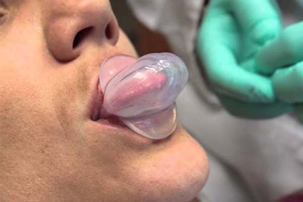 Best CPAP Alternatives for Mouth Breathers 4